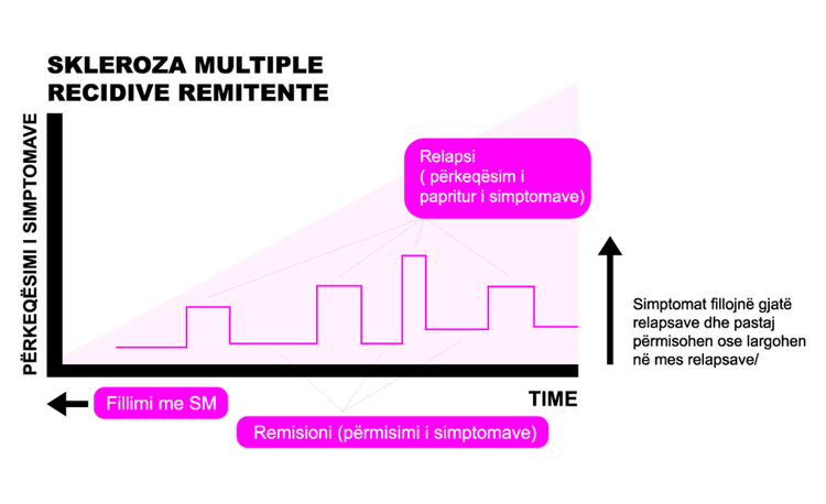 Grafik: Në rastin e SMRR, sëmundja avancon në mënyrë konstante me kalimin e kohës, ndërsa simptomat përkeqësohen periodikisht dhe pasohen nga një rikuperim thuajse i plotë