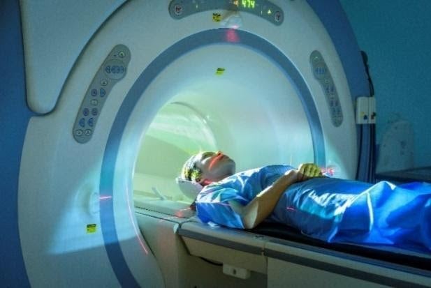 MRI snimak koji pomaže zdravstvenom timu da utvrdi dijagnozu multipla skleroze