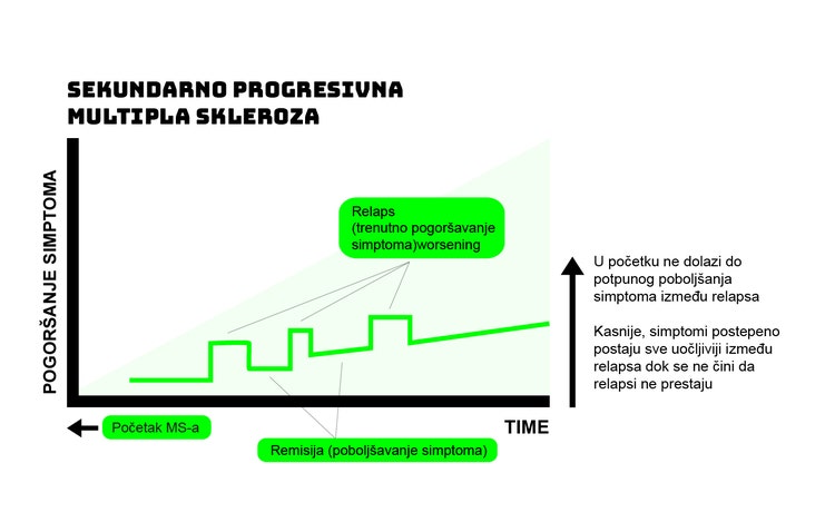 Grafikon generalno prikazuje progresiju multipla skleroze MS i ne zasniva se na nekom konkretnom pacijentu.