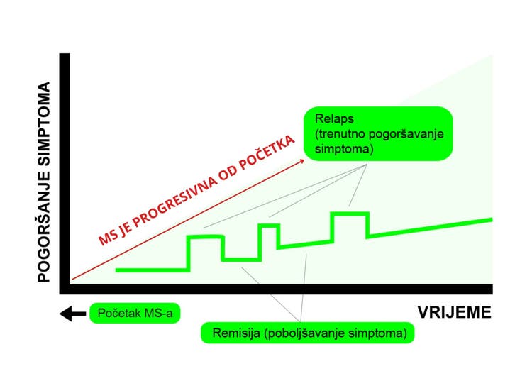 Grafikon pokazuje kako se simptomi multiple skleroze mogu javljati vremenom (zelena linija) i šta se dešava što ne možete vidjeti.