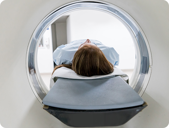 Multipla skleroza (MS) MRI sken | MS Resistance