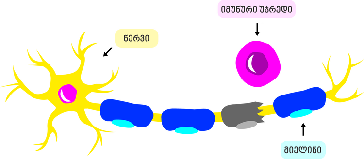 An immune cell damaging myelin on a nerve cell.